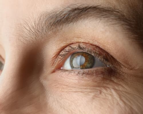 Cataracts Exam at Gateway Eye Care New Hartford NY