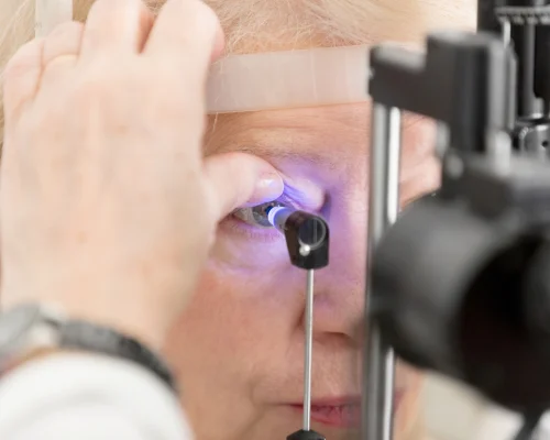 Glaucoma treatment